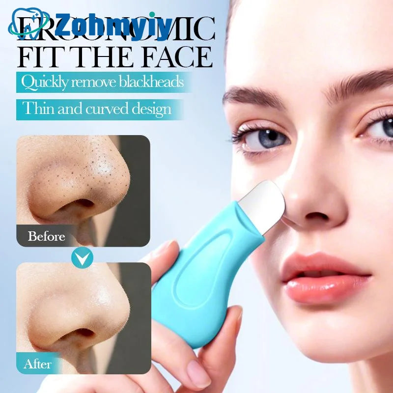 ZOHMYIY Blackhead Remover Tool — Deep Pore Cleansing & Skin Refinement