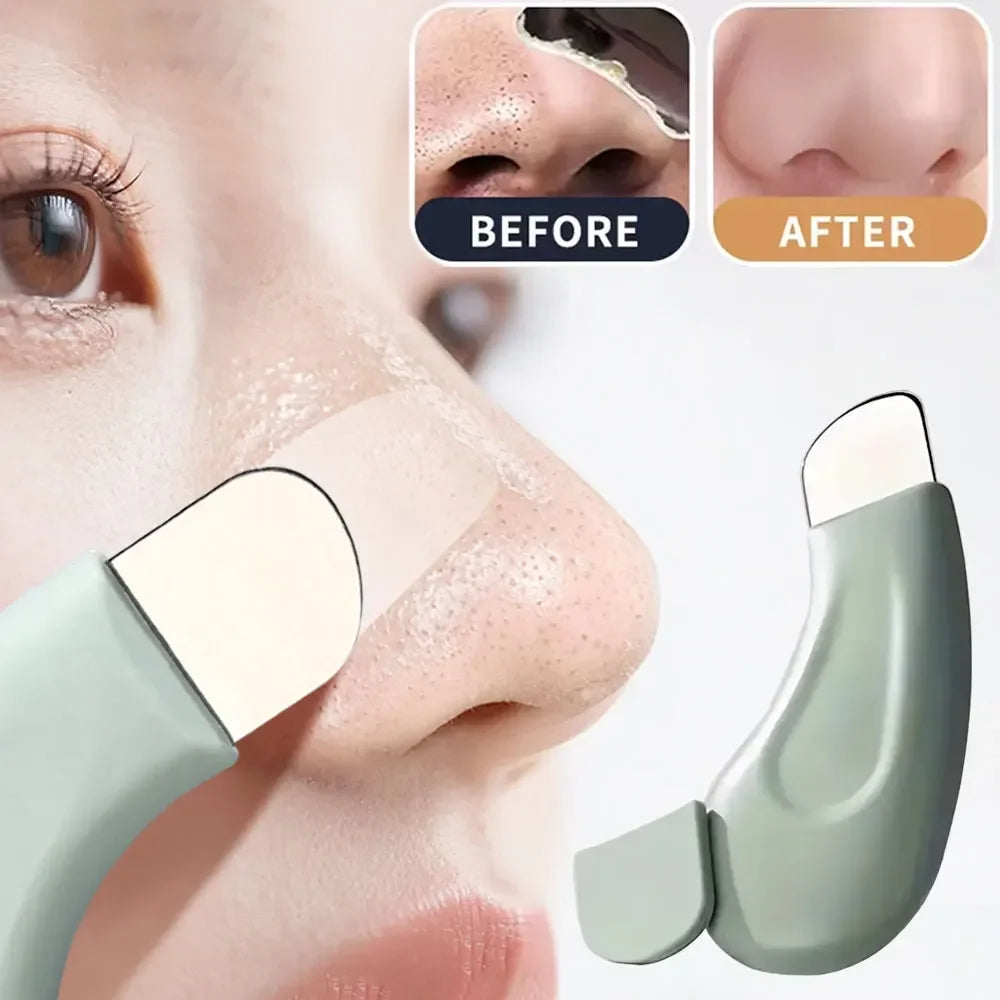 Deep Cleansing Pore Tool — Blackhead and Whitehead Remover for Face