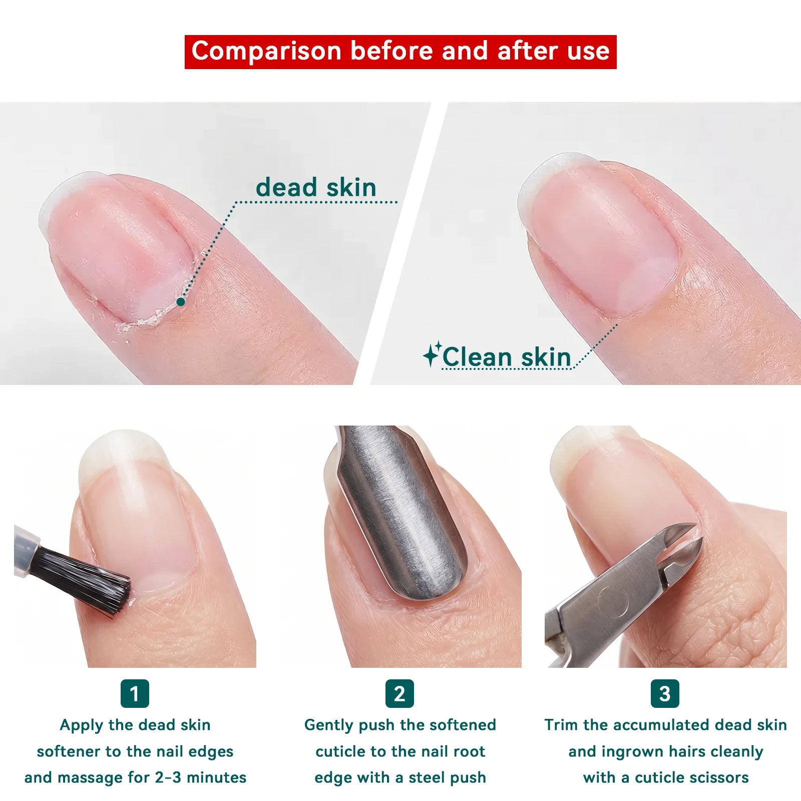 Misscheering Cuticle Nipper Set — Professional Stainless Steel Nail Trimmer
