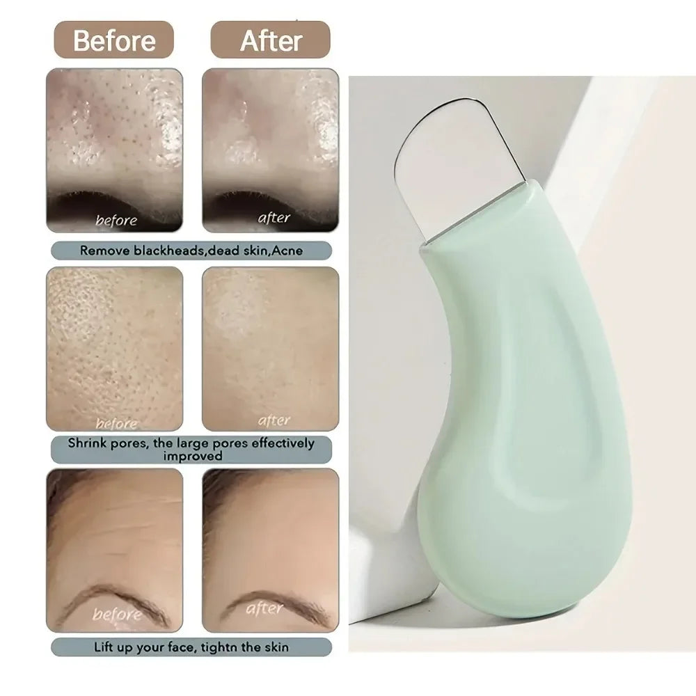Manual Blackhead Scraper — Facial Beauty Tool for Skin Care