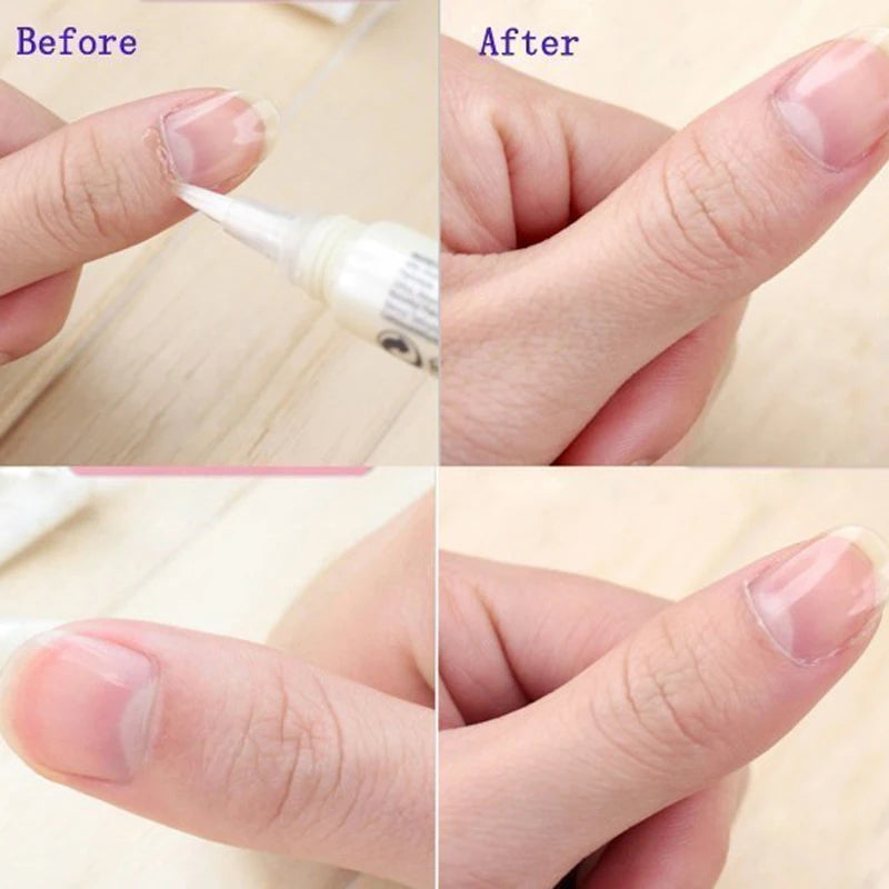 Nail Cuticle Oil Pen Set — Nourishing Manicure Treatment for Soft Skin