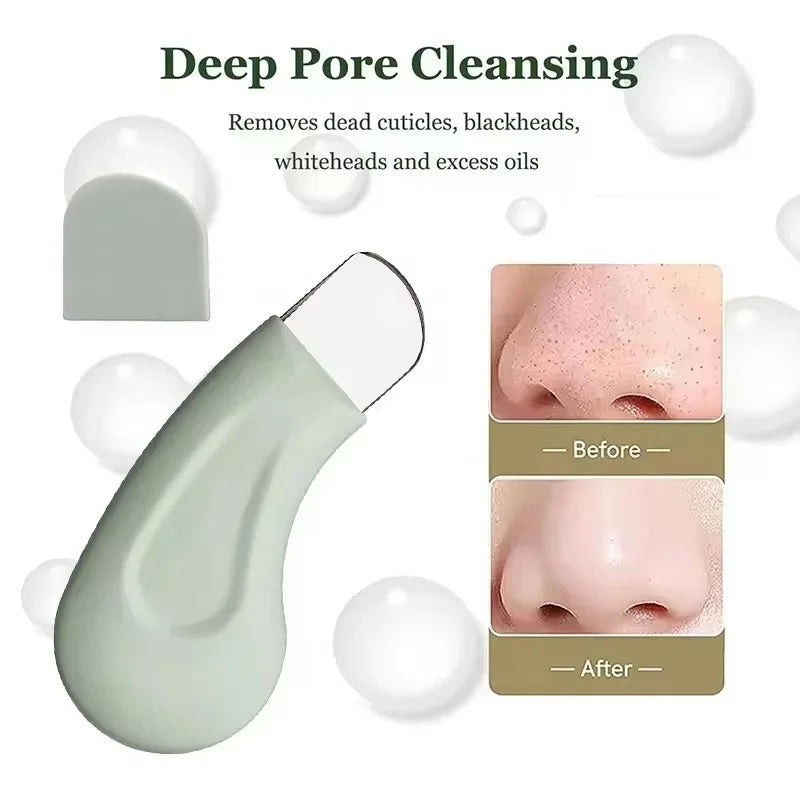 Blackhead & Whitehead Remover Tool — Pore Cleaning Facial Skin Care Brush