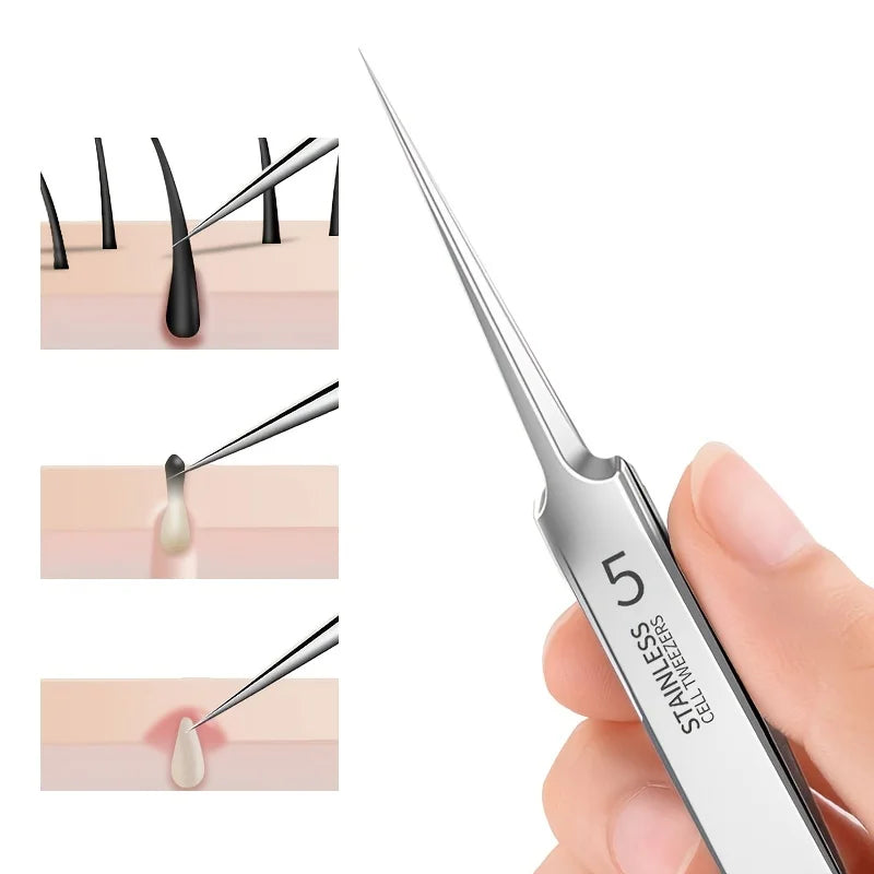 Liplns Blackhead Removal Tweezers — Stainless Steel Comedones Extractor