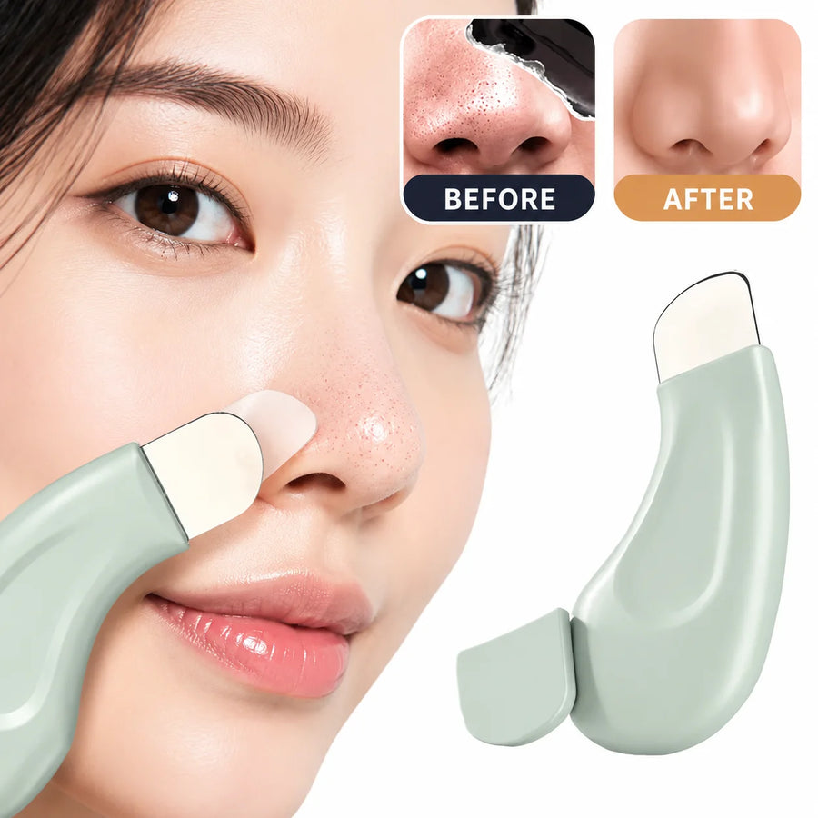 Stainless Steel Blackhead Remover — Deep Cleansing Facial Skin Care Tool