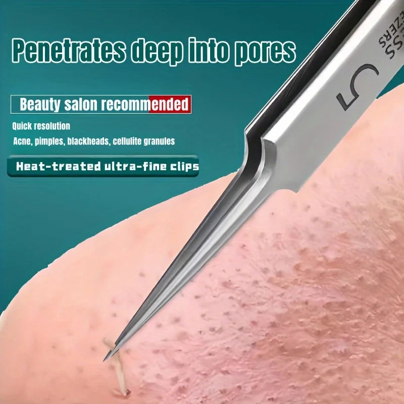 Liplns Blackhead Removal Tweezers — Stainless Steel Comedones Extractor
