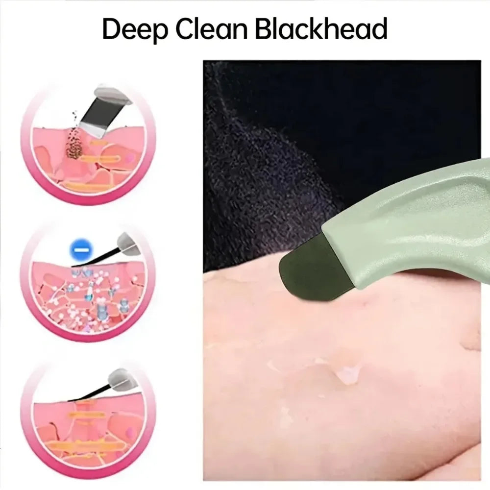 Manual Blackhead Scraper — Facial Beauty Tool for Skin Care